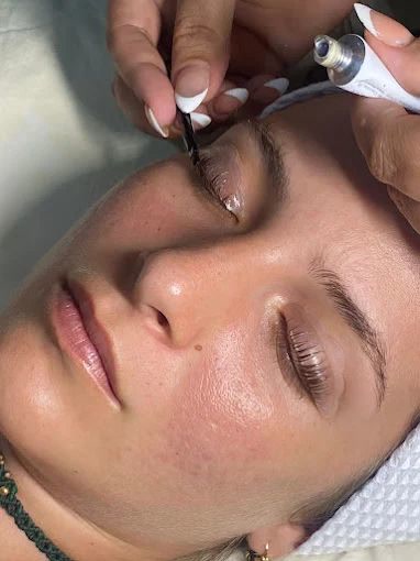 Premium Facial Treatments at Aurora